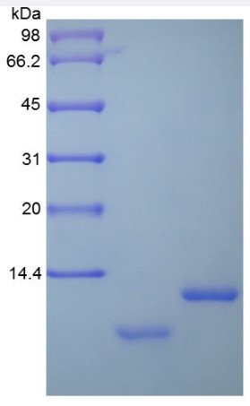 SDS-PAGE (SCGB1A1-533H).jpg